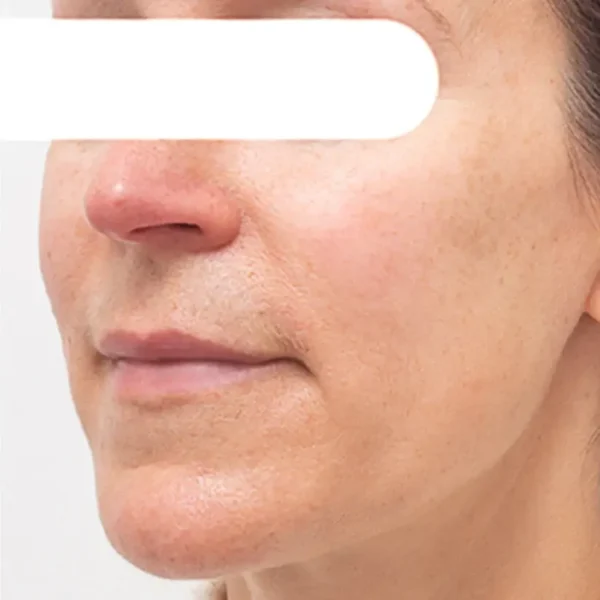 AEXZR® Herbal Flecken Peel-Off Gesichtsmaske | BEGRENZTES RABATTANGEBOT✨