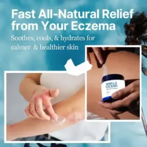 AEXZR® Ocean Healed Eczema Soothing Cream