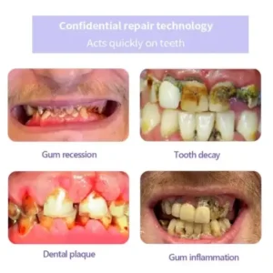 AEXZR® Teeth Restoration Mineral Powder