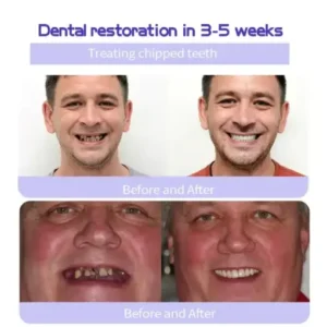 AEXZR® Teeth Restoration Mineral Powder