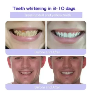 AEXZR® Teeth Restoration Mineral Powder