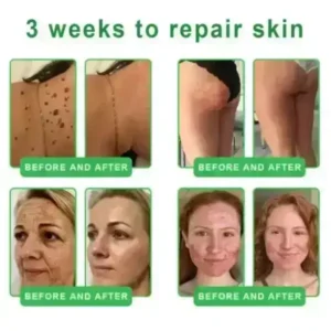 𝐎𝐫𝐢𝐚𝐜𝐡® 𝐀𝟏𝟎+ 𝟔-𝐢𝐧-𝟏 𝐃𝐞𝐫𝐦𝐚𝐑𝐞𝐩𝐚𝐢𝐫 𝐒𝐞𝐫𝐮𝐦