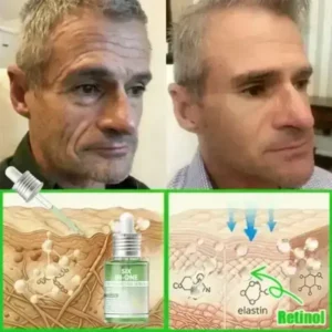 𝐎𝐫𝐢𝐚𝐜𝐡® 𝐀𝟏𝟎+ 𝟔-𝐢𝐧-𝟏 𝐃𝐞𝐫𝐦𝐚𝐑𝐞𝐩𝐚𝐢𝐫 𝐒𝐞𝐫𝐮𝐦