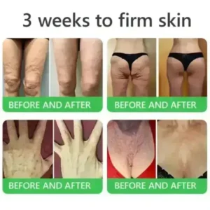 𝐎𝐫𝐢𝐚𝐜𝐡® 𝐀𝟏𝟎+ 𝟔-𝐢𝐧-𝟏 𝐃𝐞𝐫𝐦𝐚𝐑𝐞𝐩𝐚𝐢𝐫 𝐒𝐞𝐫𝐮𝐦