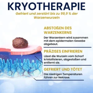 AEXZR® Hautanhängsel-Kryo-Behandlungsspray