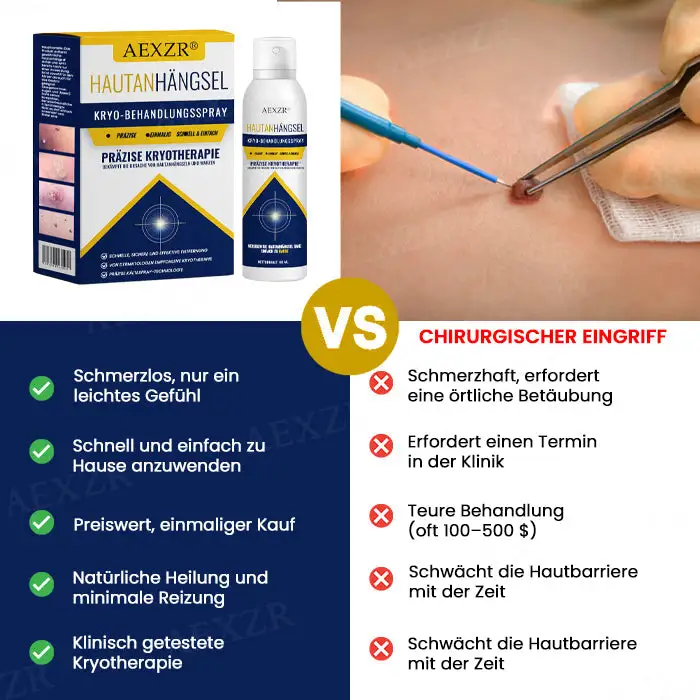 AEXZR® Hautanhängsel-Kryo-Behandlungsspray