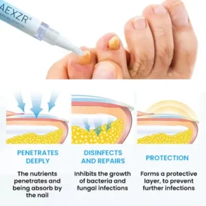 AEXZR® NanoFix Nail Repair Pen 2026 | Healthy Nail Support