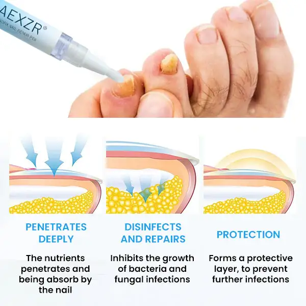 AEXZR® NanoFix Nail Repair Pen 2026 | Healthy Nail Support