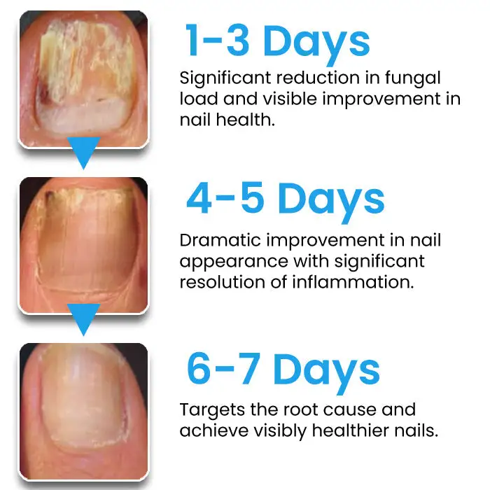 AEXZR® NanoFix Nail Repair Pen 2026 | Healthy Nail Support
